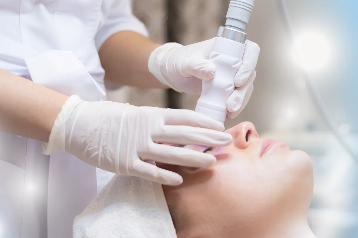 Trị mụn chuyên sâu tại VyBrows